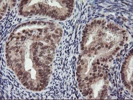 TP53 / p53 Antibody (clone OTI2H6, Carrier-free)