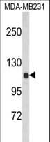 ACTN1 Antibody (aa1-30)