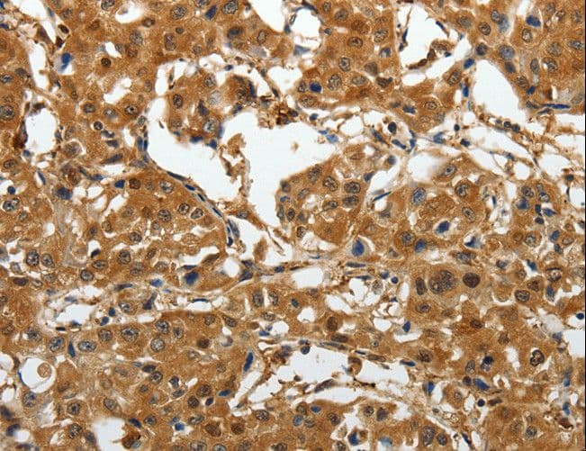 Gravin / AKAP12 Antibody