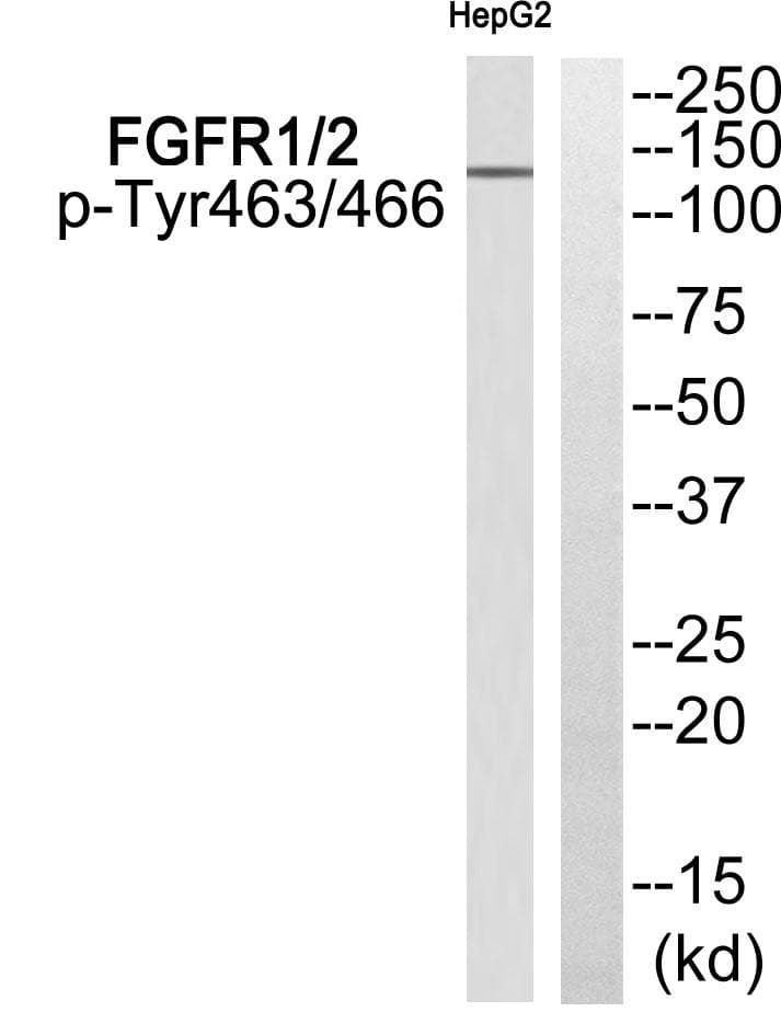 FGFR1 / FGF Receptor 1 Antibody (phospho-Tyr463/466)