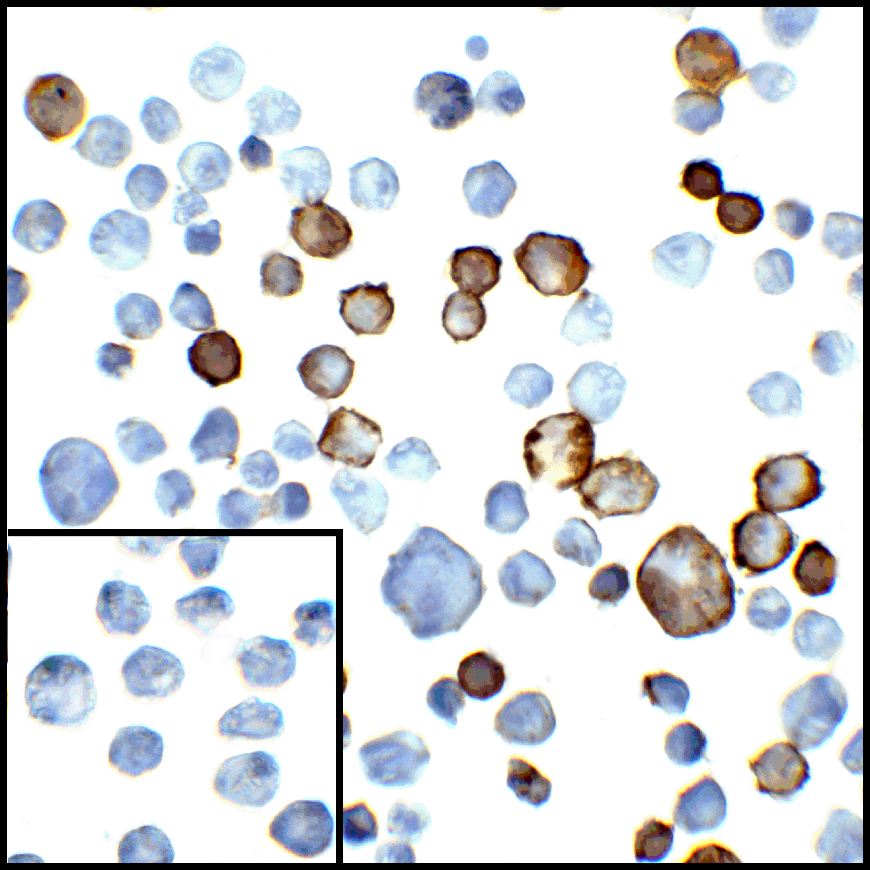 PD-L2 / PDCD1LG2 / CD273 Antibody (clone 7C1)