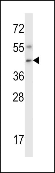 NIM1K / NIM1 Antibody (aa352-380)