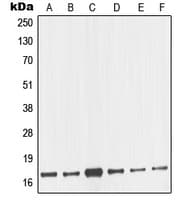 Polyclonal Rabbit anti-Human NME2 Antibody (Internal, WB)