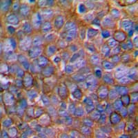 MAP2K1 / MKK1 / MEK1 Antibody (Internal)