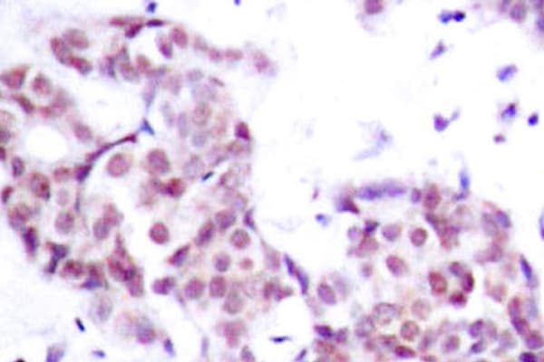 STAT6 Antibody (phospho-Tyr641)