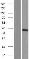 Human DAZL Protein (Over-Expression Lysate Myc-DDK (Flag))