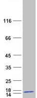 Human BLOC1S2 Protein (Recombinant Myc-DDK (Flag))