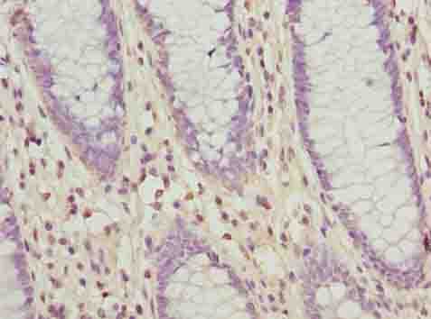 SLC30A6 Antibody