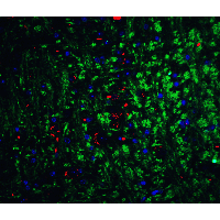 NRTN / Neurturin Antibody