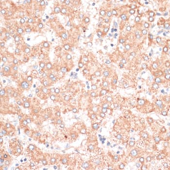 ABCB7 Antibody