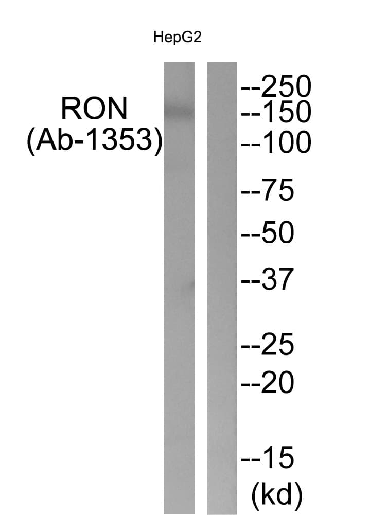 MST1R / RON Antibody