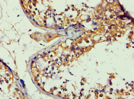 APBB1 / FE65 Antibody (aa361-710)