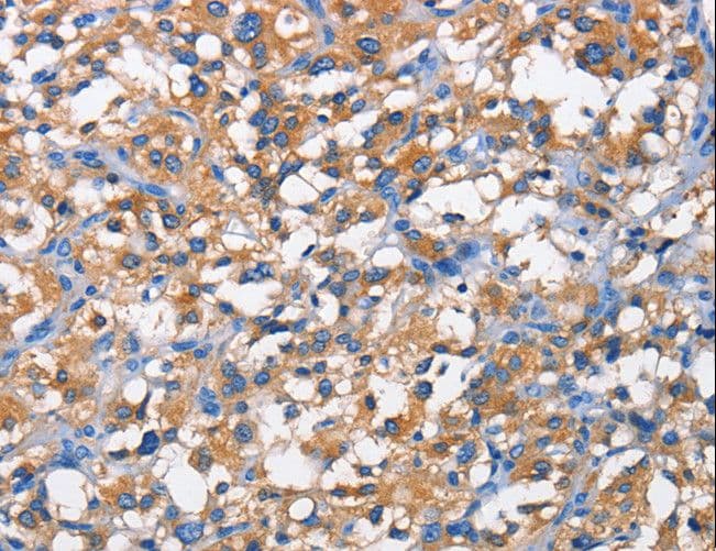 PFKP Antibody