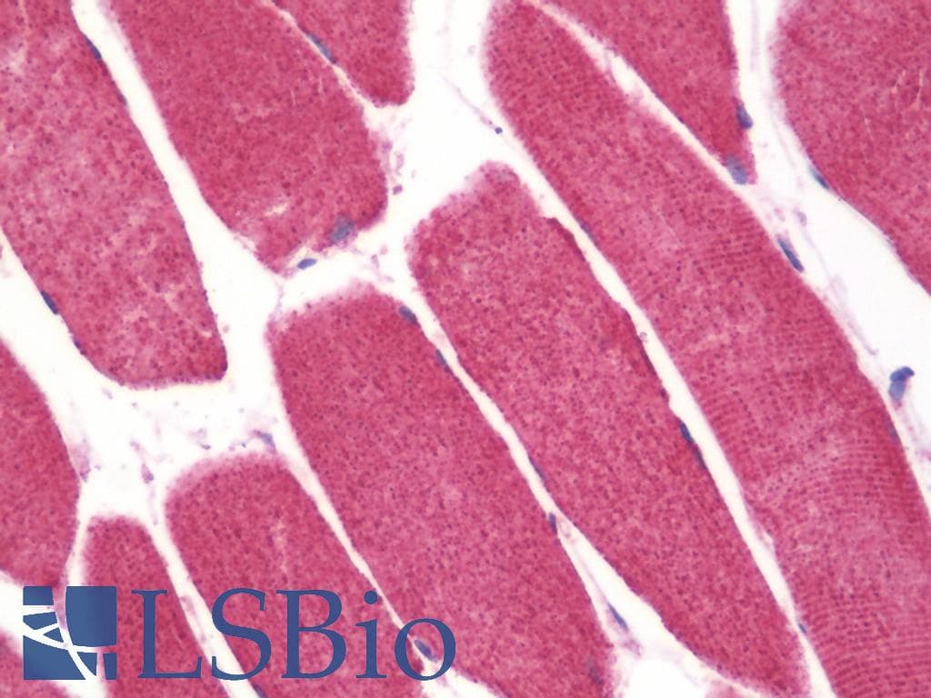 PathPlus™ SLC40A1 / Ferroportin-1 Antibody (Internal)