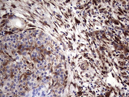 LGALS3 / Galectin 3 Antibody (clone OTI7G9)