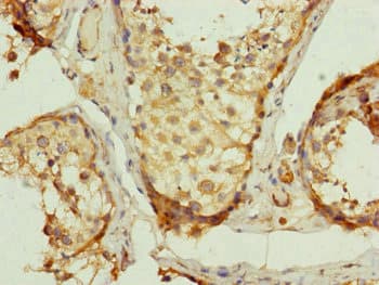 QCR2 / UQCRC2 Antibody