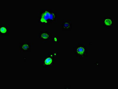 Polyclonal Rabbit anti-Human Carboxylesterase 3 / CES3 Antibody (IHC, IF)