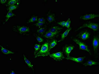 Polyclonal Rabbit anti-Human TMEM56 Antibody