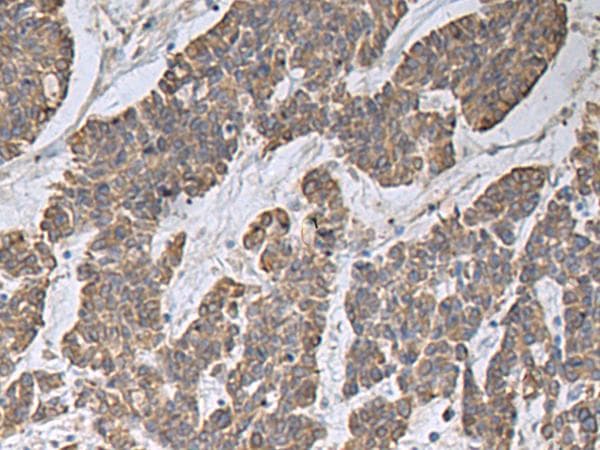 Polyclonal Rabbit anti-Human CCNF / Cyclin F Antibody (IHC, WB)