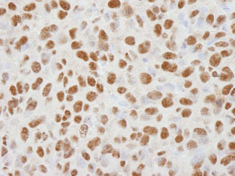Polyclonal Rabbit anti-Human HDAC1 Antibody (aa425-C-term, IHC, IF)