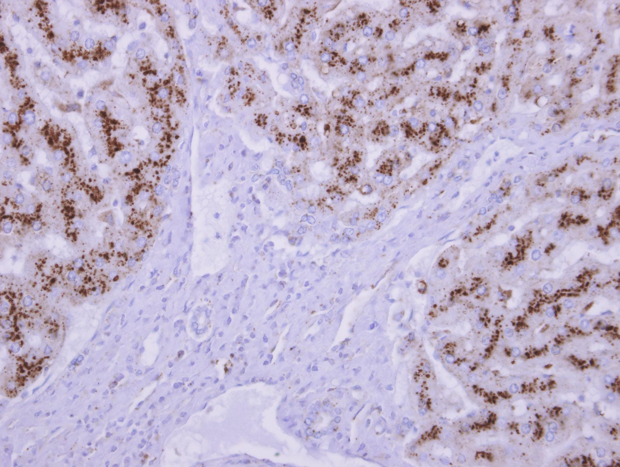 TPP1 / CLN2 Antibody (aa224-563)