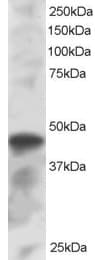 IHC-plus™ ICSBP / IRF8 Antibody (aa414-426)