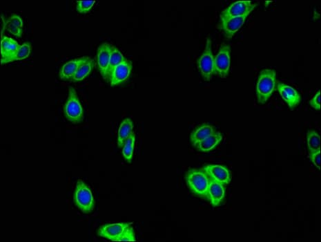 WFDC8 Antibody