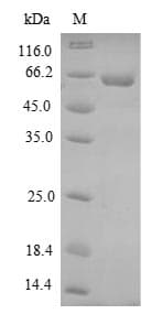 Dog DMP1 Protein (Recombinant 6His-SUMO, N-terminus)
