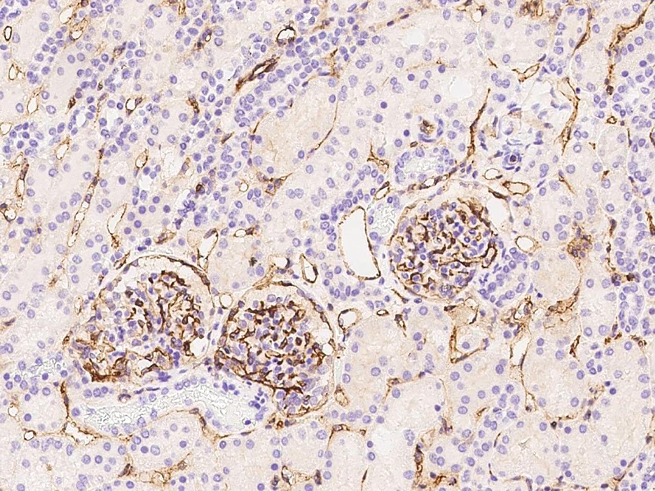Polyclonal Rabbit anti-Human ICAM-1 / CD54 Antibody (Preservative Free, IHC, IF)