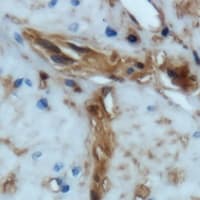 ENAH / MENA Antibody (C-Terminus)
