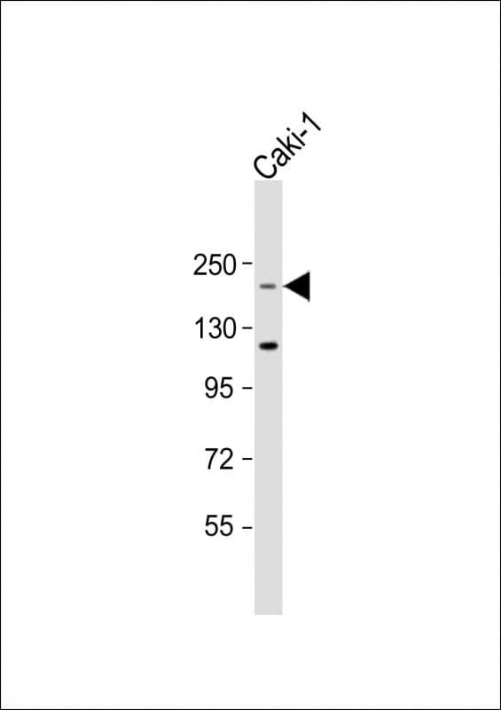 Polyclonal Rabbit anti-Human TRIP12 Antibody (aa991-1023, WB)