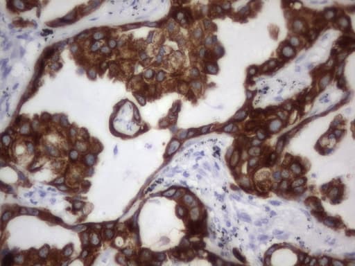 Acidic Cytokeratin Antibody (clone 3E10)