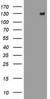 PR / Progesterone Receptor Antibody (clone OTI1B3)