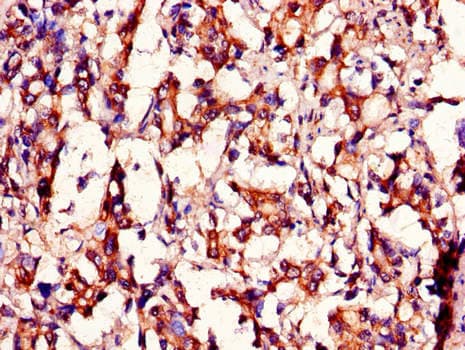 Polyclonal Rabbit anti-Human MED12 Antibody (IHC)