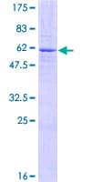 Human ZNF177 / PIGX Protein (Recombinant GST)