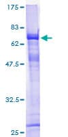 Human ELMOD3 Protein (Recombinant GST)