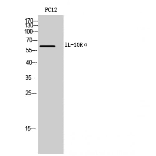 IL10RA Antibody (151-200 aa, Internal)