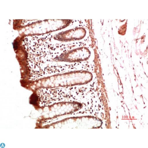 Collagen II Antibody