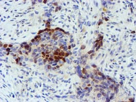 FOXI1 Antibody (clone OTI2H5)