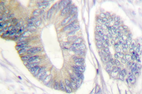 Polyclonal Rabbit anti-Human p66 / SHC Antibody (Leu421, IHC, WB)