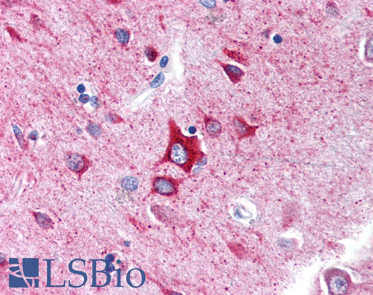 GABRA1 Antibody (N-Terminus)