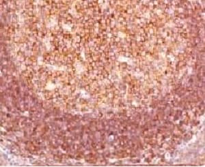 BCL10 / BCL-10 Antibody (clone MUBC10)