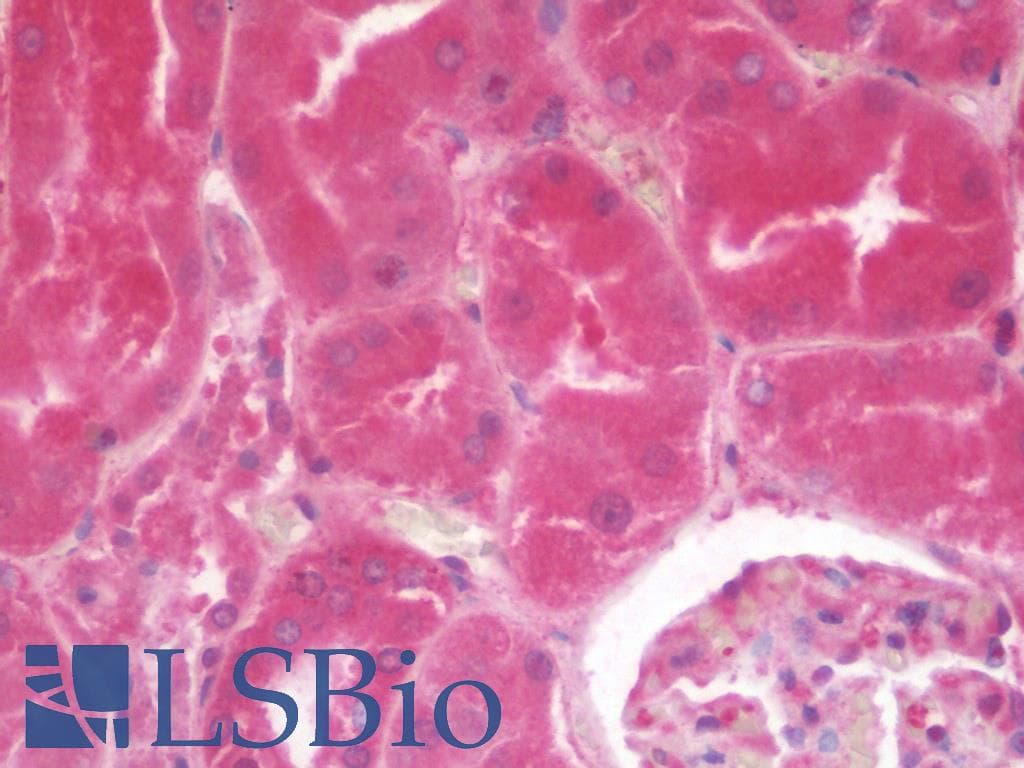 IHC-plus™ IL3RA / CD123 Antibody (aa200-305, clone 10B8E7)