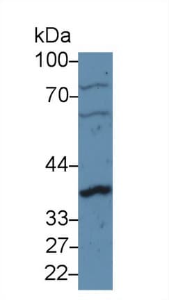 CCND1 / Cyclin D1 Antibody (aa1-295, Biotin)