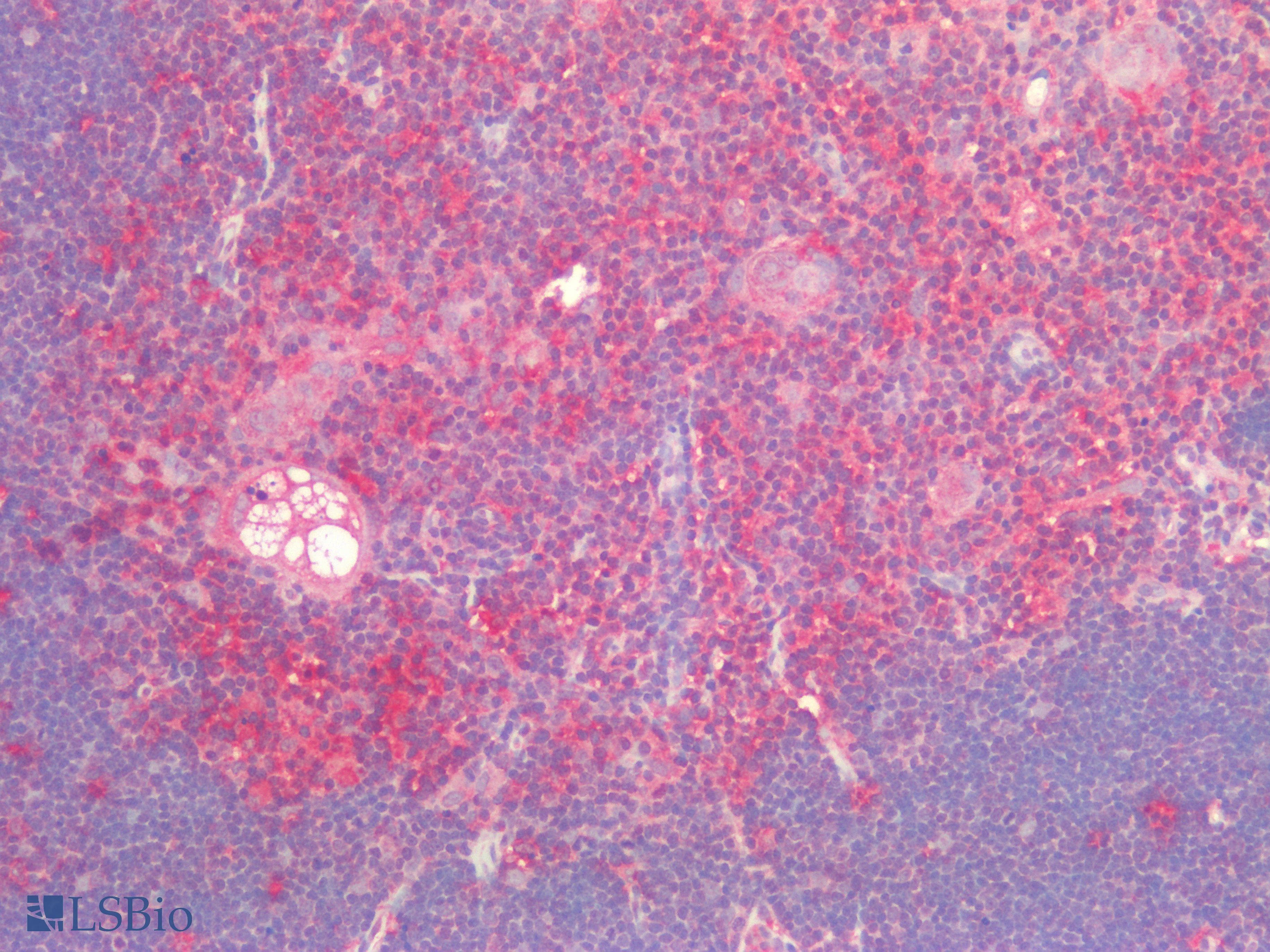 IHC-plus™ TP53 / p53 Antibody
