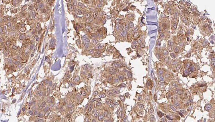EPB41L2 Antibody