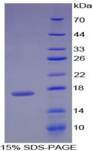 Rat RBP1 / CRBP Protein (Recombinant His)