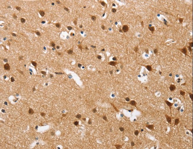 BRAK / CXCL14 Antibody