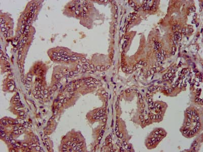 Polyclonal Rabbit anti-Human AMIGO2 Antibody (IHC, IF, WB)