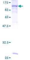 Human FES Protein (Recombinant GST)